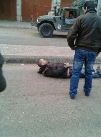 صورة الجريح باطلاق رصاص عليه في التبانة بطرابلس
