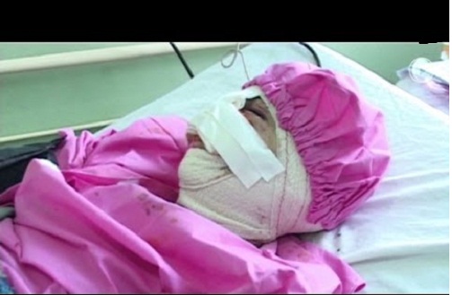رجل يعاقب زوجته بقطع أنفها وشفتيها