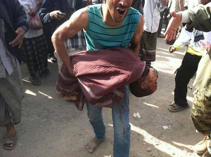 13 قتيل وعشرات الجرحى في قصف مخيم عزاء بالضالع جنوب اليمن 