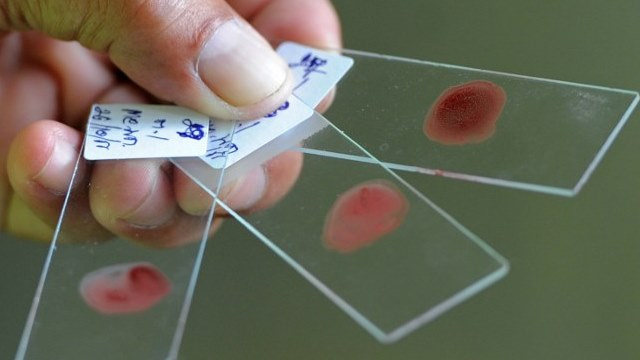 إنشاء لقاح شامل مضاد للملاريا