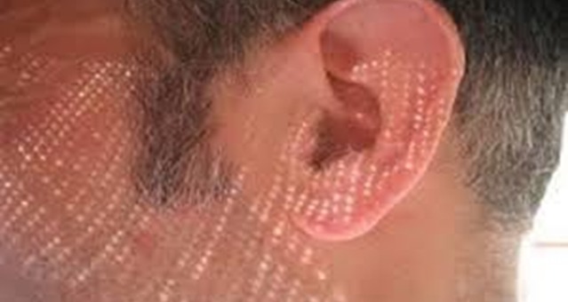 الأذن الصناعية ذات الأبعاد الثلاثية أحدث الاختراعات