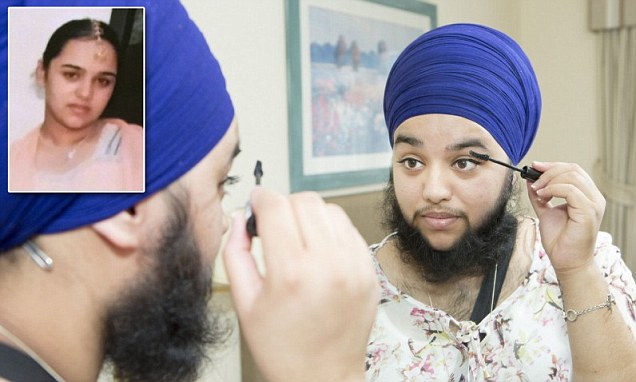 بالفيديو.. فتاة تعاني من الشعر الزائد وتتحول الى رجل