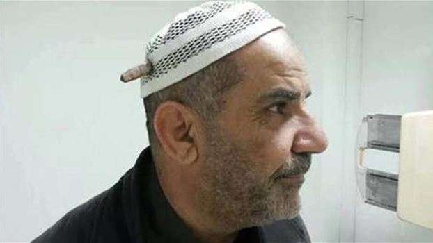 اعجوبة بالصورة: رصاصة قناص علقت برأسه ولم تخرقه
