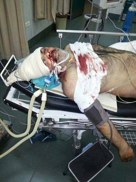 بالصورة.. الشاب حسام الشوّا ضحية إطلاق نار في تظاهرات الداعمة لعرسال
