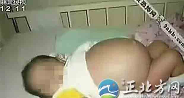 لن تصدق..رضيع يلد شقيقه التوأم من بطنه!