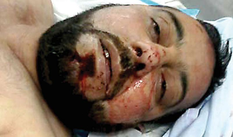 مقتل سامي الأطرش المسؤول عن تفجير السيارات وقصف الصواريخ على البقاع الشمالي الشرقي ...
تفاصيل الخطة الأمنية كما أقرها مجلس الوزراء لمنطقتي طرابلس والبقاع ...
وفد بري يسأل عن تاريخ الجلسة وعن الرأي في التعديل الدستوري للموظفين المرشحين