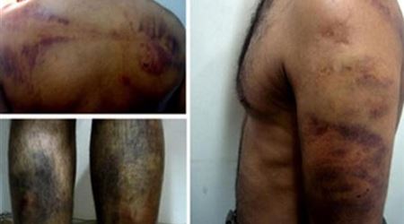  عذّبت زوجها بالفلفل الأحمر والسلاسل 