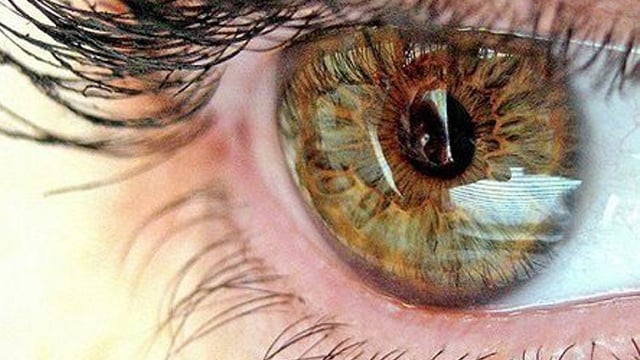 صورة طفلة في فيسبوك تنقذ لها بصرها
