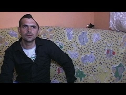 بالفيديو.. يفقد نصف رأسه ويبقى على قيد الحياة