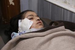 18 قتيلا بينهم عشرة اطفال في قصف للطيران السوري على مدرسة في حلب
