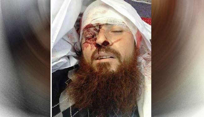 مقتل السعودي "ابو بكر النجدي" الامير بجبهة النصرة في حلب
