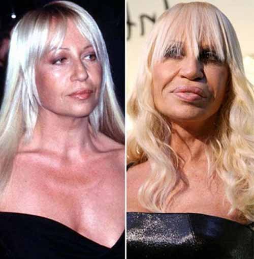 21 صورة لعمليات تجميلٍ فاشلة