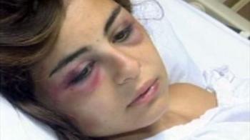 تمارا حريصي ضحية جديدة بسبب وحشية زوجها!