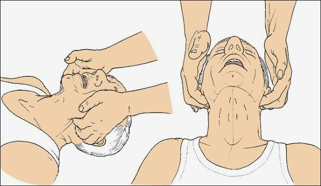 حقيقة بلع اللسان الأسباب وطرق الإنقاذ السريعة مهم جداا 

