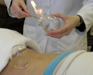 فوائد الحجامة وعلاج الأمراض 

