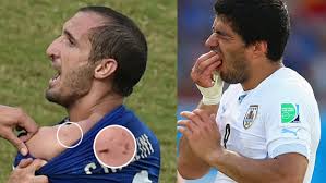 سواريز يعتذر أخيرا عن واقعة العض في كأس العالم
