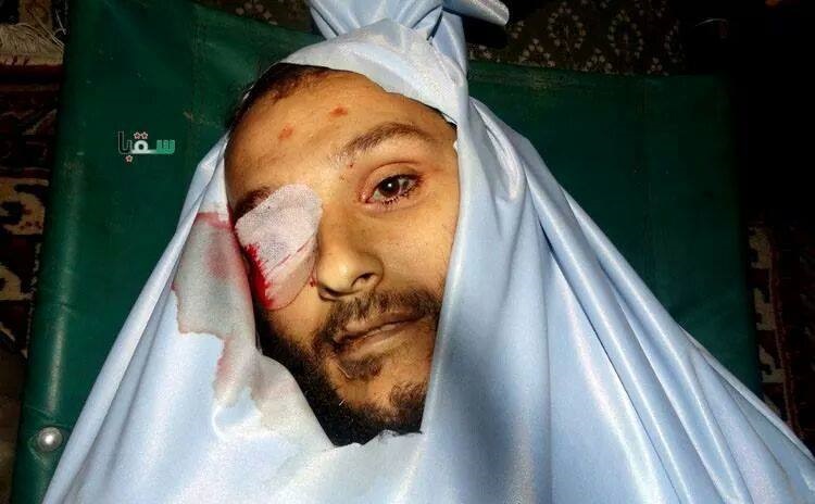 بالفيديو..اغتيال "ابو محمد هارون" القيادي بجيش الاسلام في سقبا
