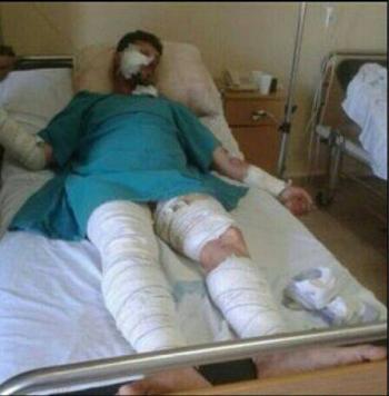 حسين عطوي احد مطلقي صواريخ حاصبيا يرقد في مستشفى المنارة