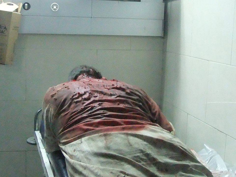 صور من المجزرة التي ارتكبها جيش الاحتلال باستهداف أحد المساجد في حي الشغف شرق عزة خلال صلاة التراويح