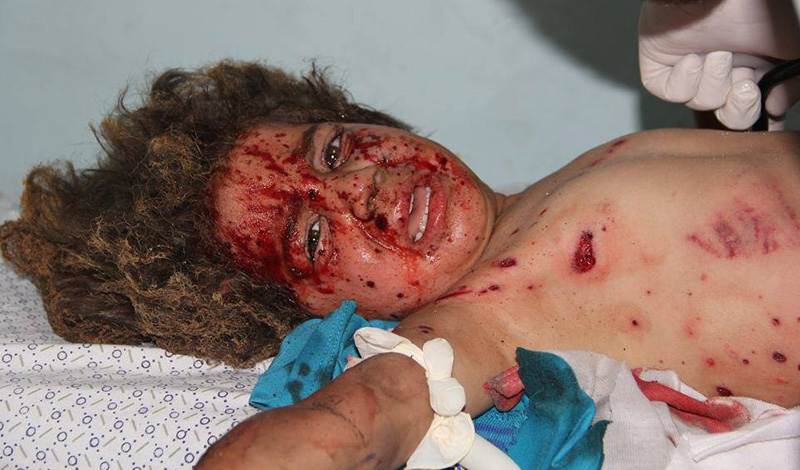 أطفال غزة بنك أهداف الطائرات الإسرائيلية والعدوان حصد 250 شهيداً