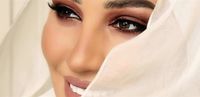 الكدمات تعلو وجه نجمة "ذا فويس".. ماذا حصل لها؟ (صورة)