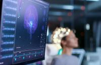 كيف نحمي أنفسنا من الزهايمر؟