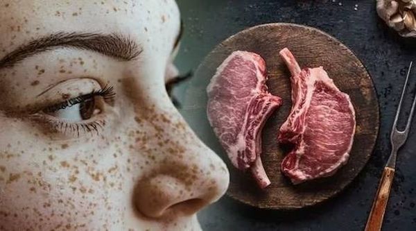 3 مؤشرات على الوجه تدل على نقص فيتامين B12