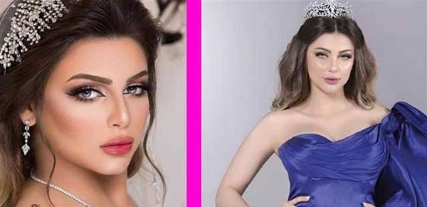 سجن ملكة جمال لدهسها طفلين مشردين!