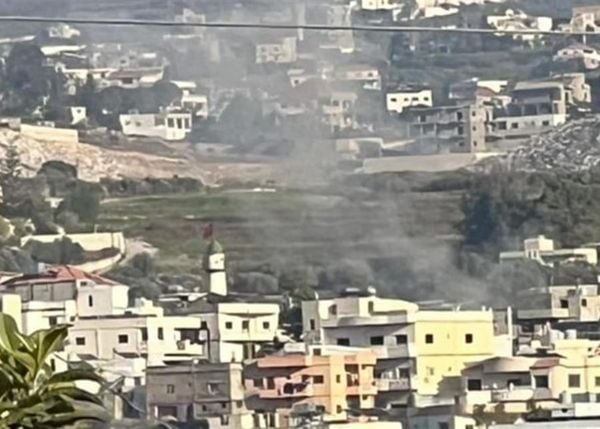 إصابة طفل بانفجار جسم من مخلفات الحرب في دبعال