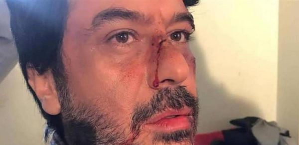 بالصورة- ما حقيقة تعرض نجم "باب الحارة" للضرب المبرح على يد 4 شبان؟