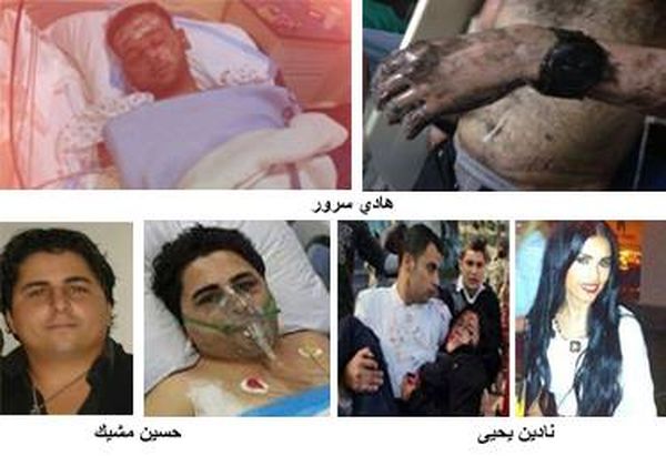 جرحى الانفجارات من معاناة الى معاناة ...
ابو فاعور ل