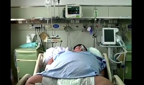 بالفيديو-  رجل  وزنه 300 كلغ والأطباء يحاولون المساعدة (فيديو)


