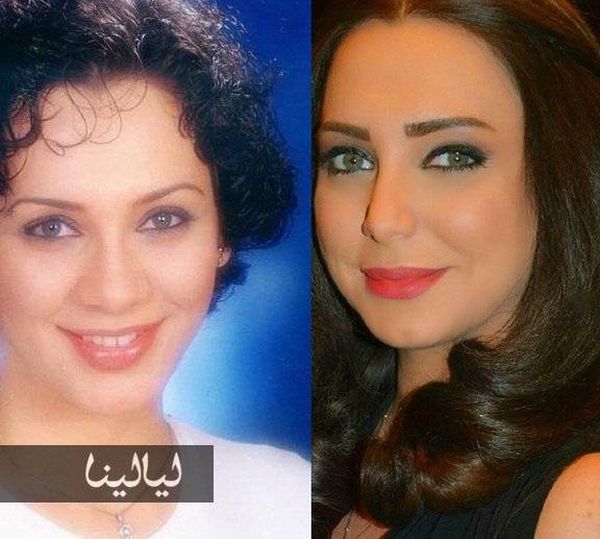صور أجمل نجمات سوريا قبل التعديلات.. كيف كانوا وكيف أصبحوا!