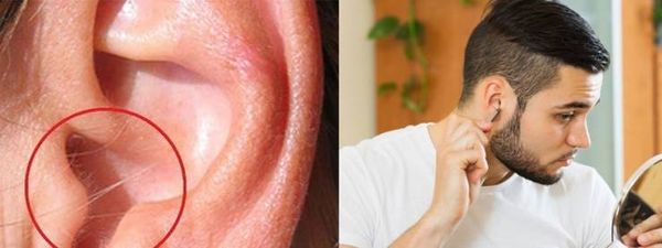 ما علاقة شعر الأذنين بالتجلطات القلبية؟