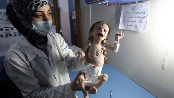أكبر مأساة في الغوطة الشرقية