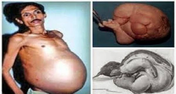 بالفيديو: رجل حامل والسبب لا يخطر ببال أحد !!