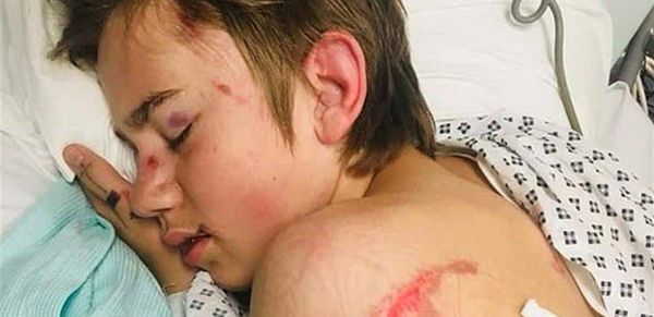 ابن الـ 14 عاماً يفقد ذاكرته.. بسبب مقلب في "الهالوين"!