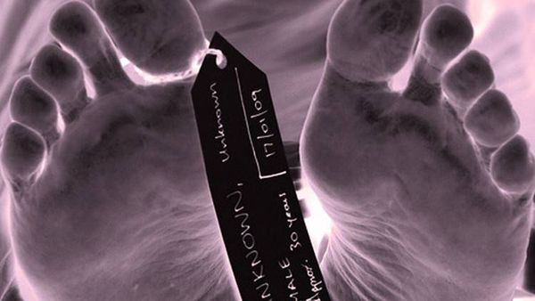 لماذا عمر الأميركي أقصر منه في بقية البلدان المتطورة؟