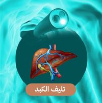 كبار السن وفقدان العضلات... هل يهدد الكبد؟