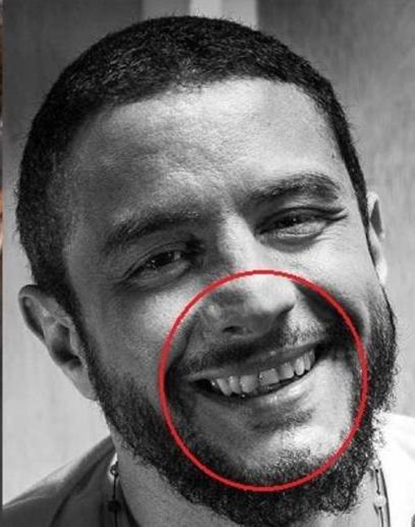 15 صورة لنجوم تفضح عيوبهم.. الصورة رقم 1 ستصدمك