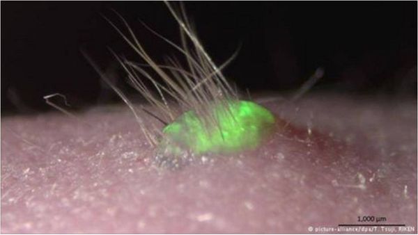 باحثون يابانيون يبتكرون طريقة جديدة لزراعة الشعر