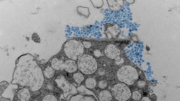 لماذا تختلف استجابة الأشخاص للفيروس عينه؟