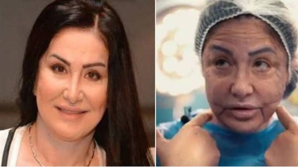 ظهور جديد للفنانة السورية وفاء سالم بعد تشوه وجهها