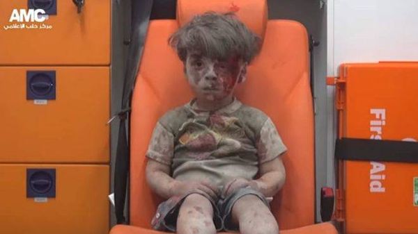 صور "عمران" طفل حلب الذي أنقذ من بين الحطام