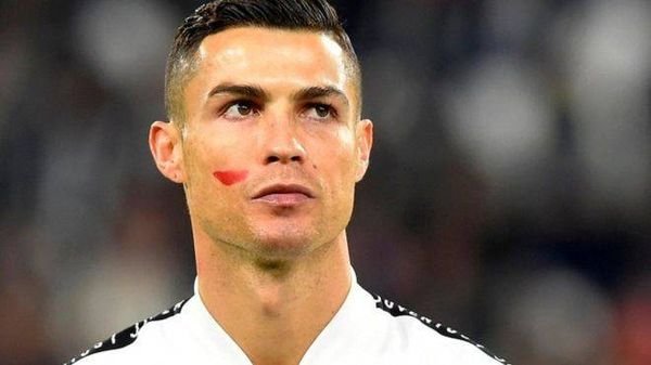 ما سرّ العلامة الحمراء على وجه كريستيانو رونالدو؟