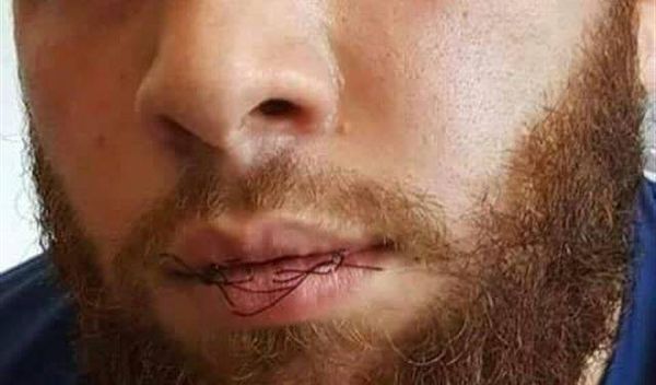 بالصور.. سُجناء في لبنان "قطبوا" فمهم