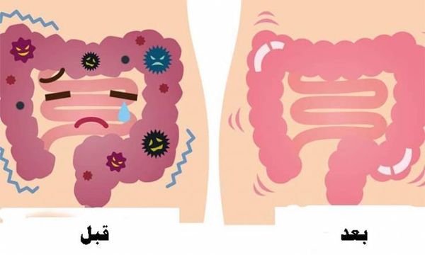 هذا العلاج الخارق  يخلصكم من الفضلات والسموم في القولون