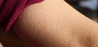 قشعريرة الجسم: جسدية ونفسية.. اليكم التفاصيل