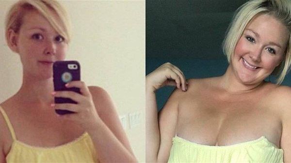 شابة تنشر صورها قبل وبعد... ما الذي تغيّر؟
