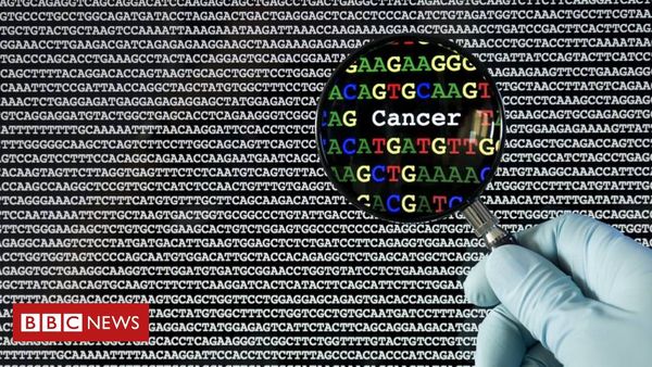 DNA 'barcode' delivering personalised breast cancer care
